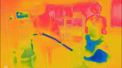 全国有多少关节炎患者,中国关节炎患者超过1亿人