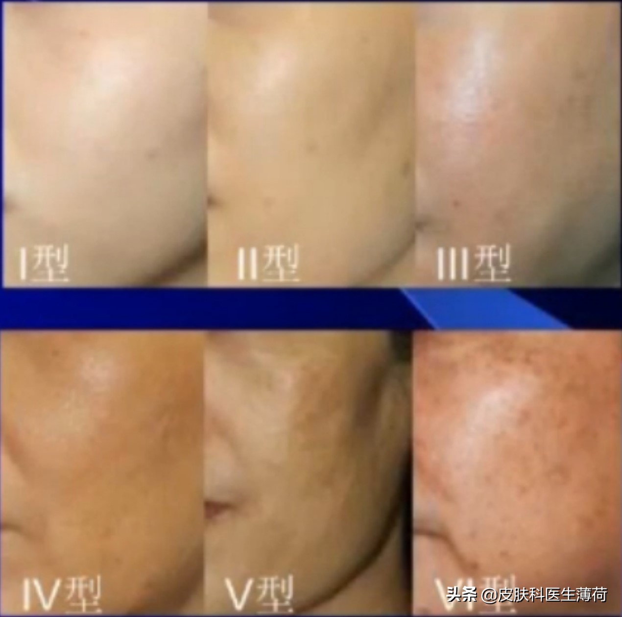 看图识皮肤病,看图识病是什么病