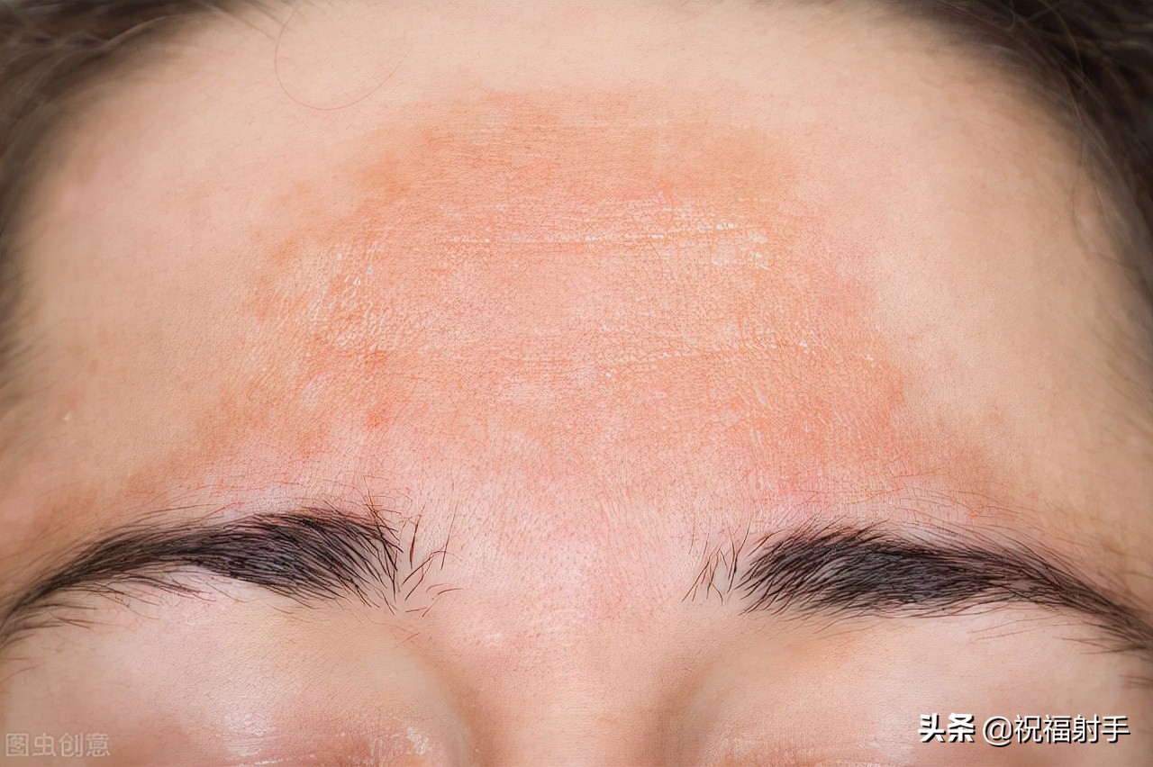 安全有效美容,最有效安全无副作用的美容方式