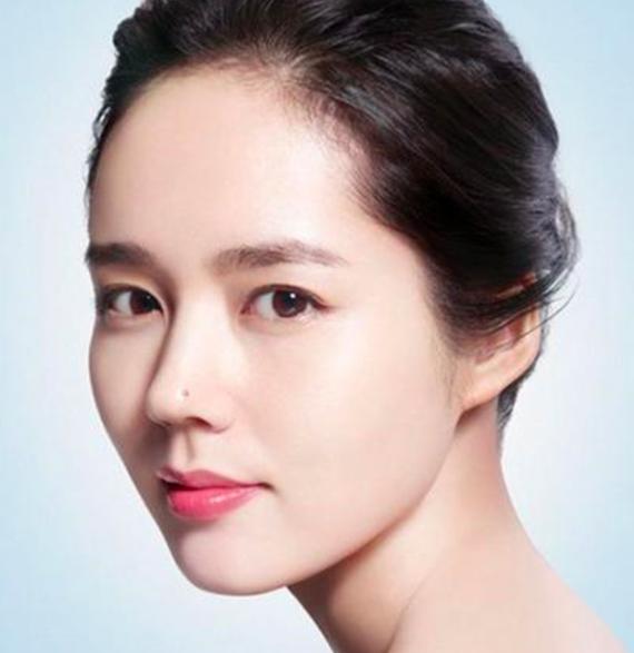 媒婆痣安崎,安崎要不要遮痣