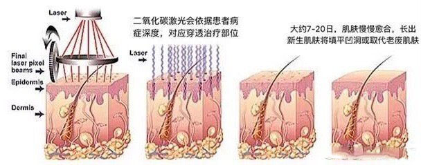 眼部周围的小点点怎么才能消除,去眼部脂肪粒的最好方法