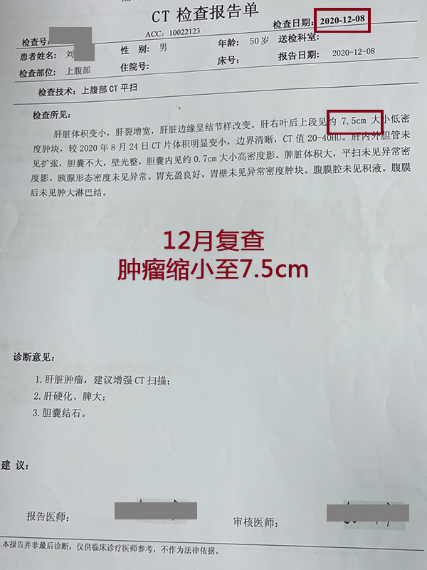 肝癌新发病例,肝癌肿瘤破裂出血会转移吗