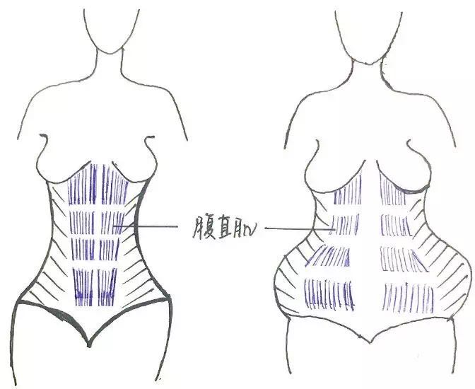 产后腰痛康复训练方法,新手宝妈产后恢复全攻略