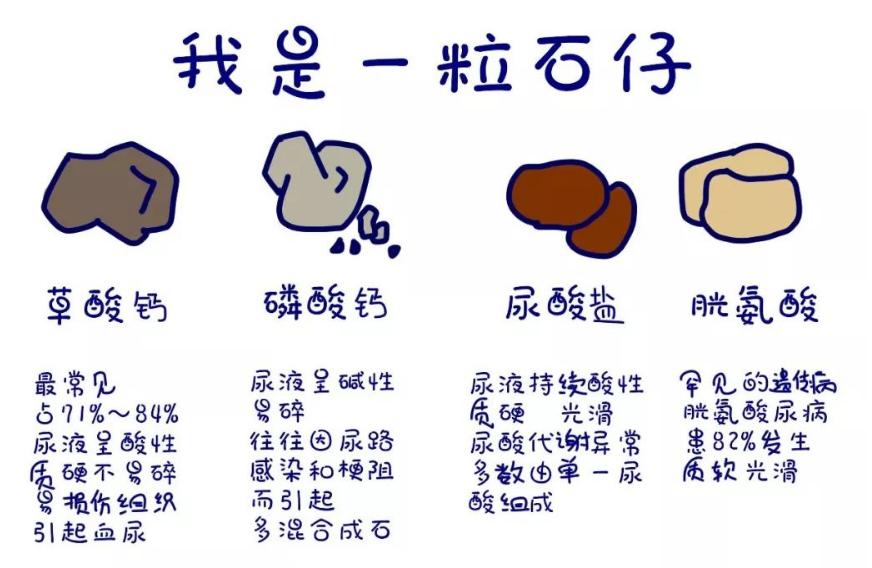 双肾结石手术后五月后又有新结石,女子右肾取出一盘结石