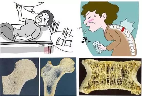 走路经常腿打软是怎么回事,走路经常腿打软当心膝盖出了问题