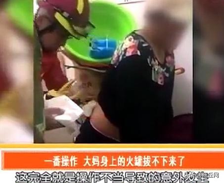 大妈在街头拔火罐,大妈拔火罐