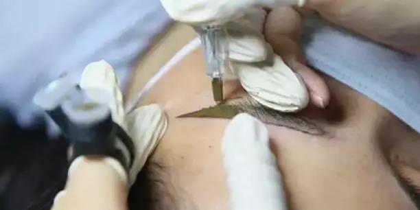 纹眉失败像什么,纹眉掉痂了眉毛怎么是红色