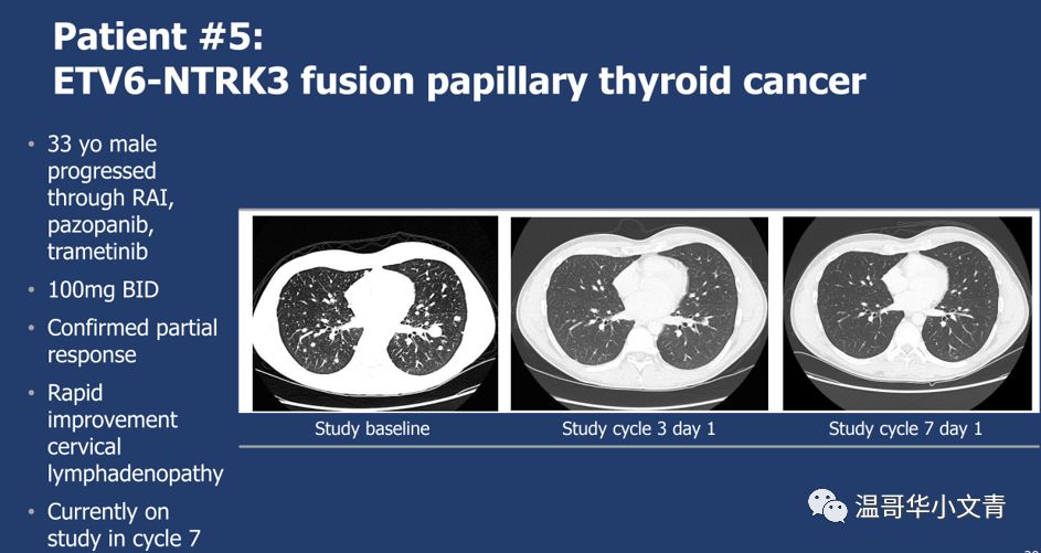 甲状腺癌进口抗癌药,2023年上市的抗癌药物针对什么癌