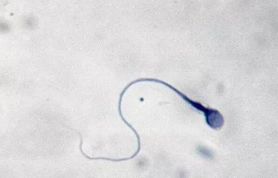 精子与卵子的秘密,精子与卵子的奥秘