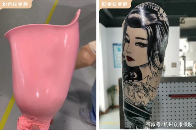 假肢接收腔选用材料详解,云南仿生假肢接收腔