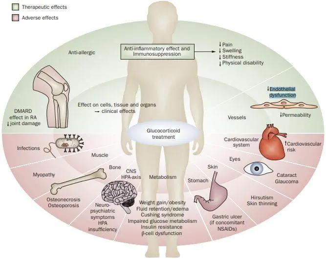 皮质激素系列（三）激素的副作用和疗程