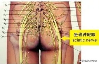 腰椎间盘突出跑步好还是跳绳好,腰椎间盘4-5节突出可以跑步吗