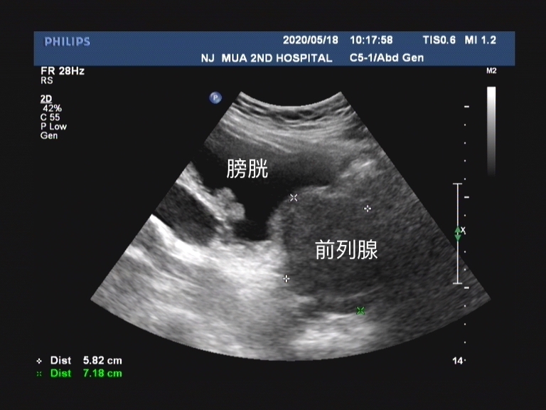 医院泌尿外科都看些什么病,哪些病需要去看泌尿外科