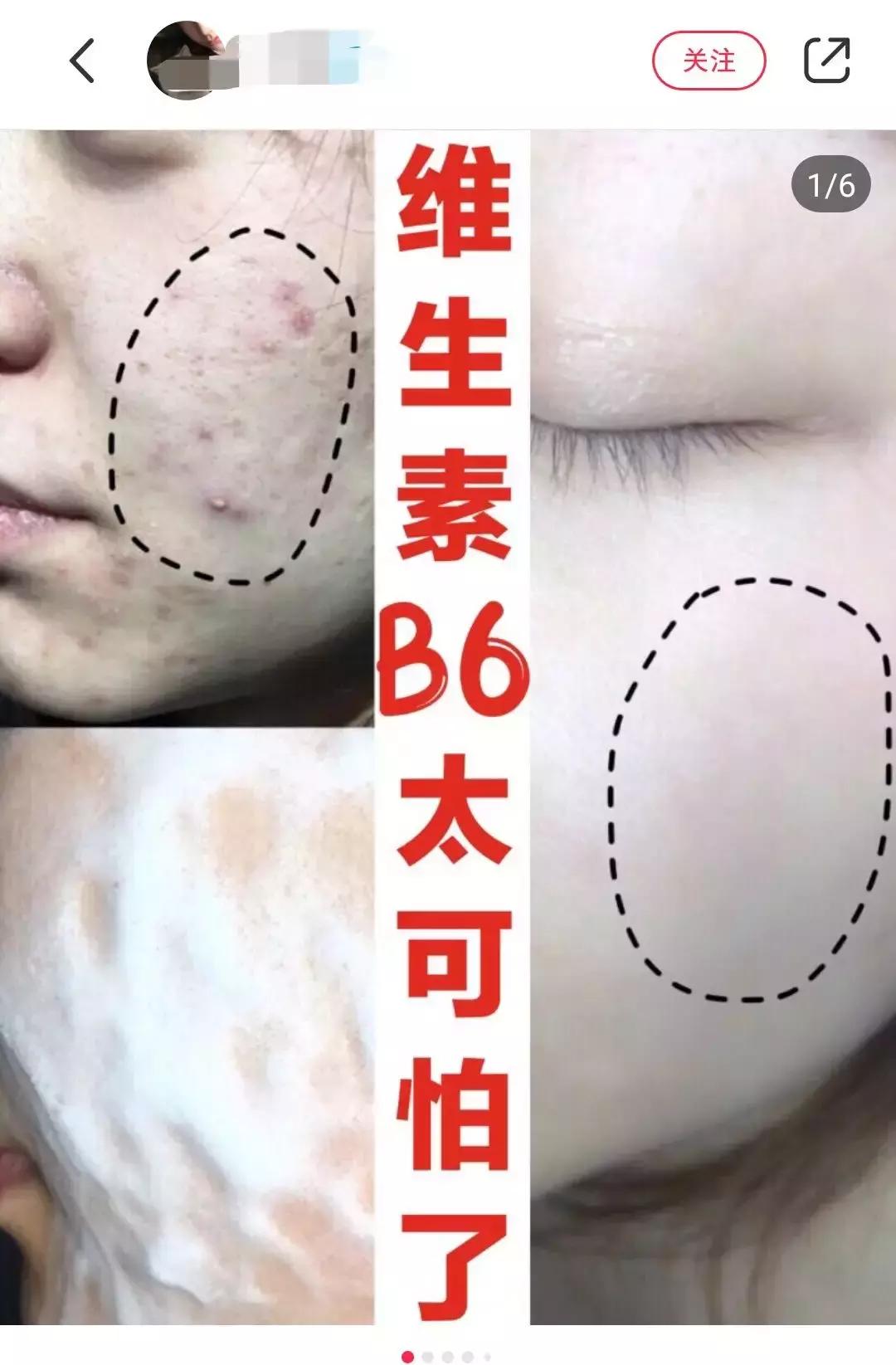 维生素e外用腋下有危害吗,维生素外用有效吗