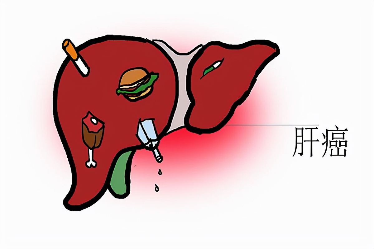 肝癌晚期无法治疗最多能活多久,肝癌晚期的患者一般能活多久