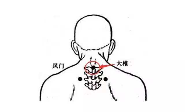 比较好的中医治疗颈椎病的书,中医治疗颈椎病的中药方