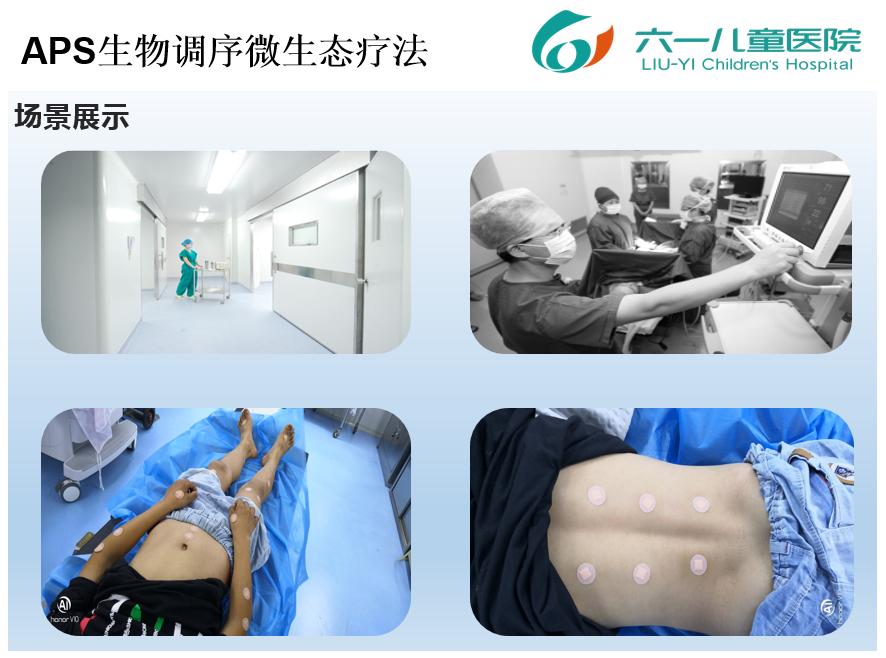 多动症干预对孩子身体有影响吗,多动症的孩子们对家庭有什么影响