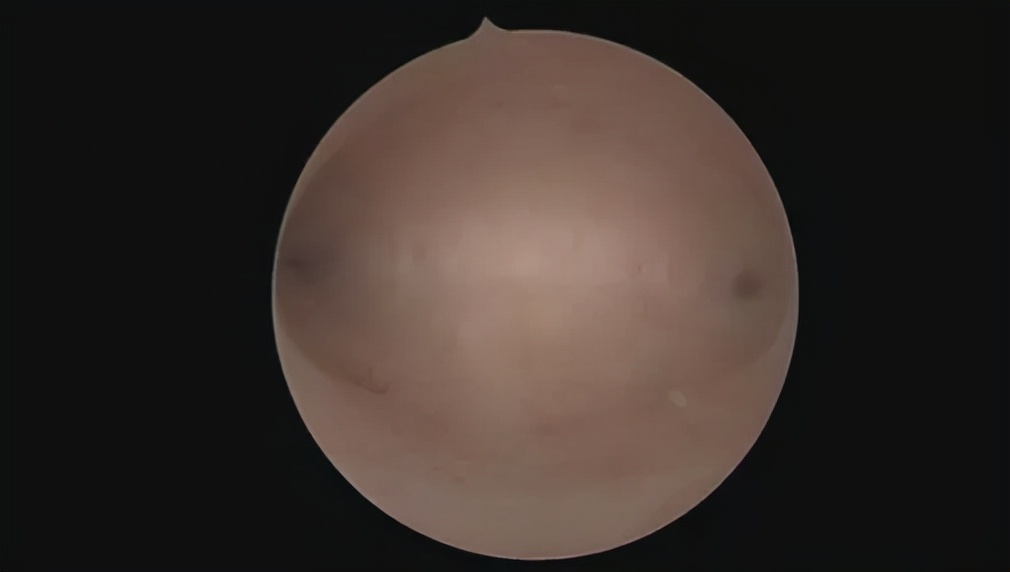 女性做amh检查要关注什么,女性检查必做项目以及时间