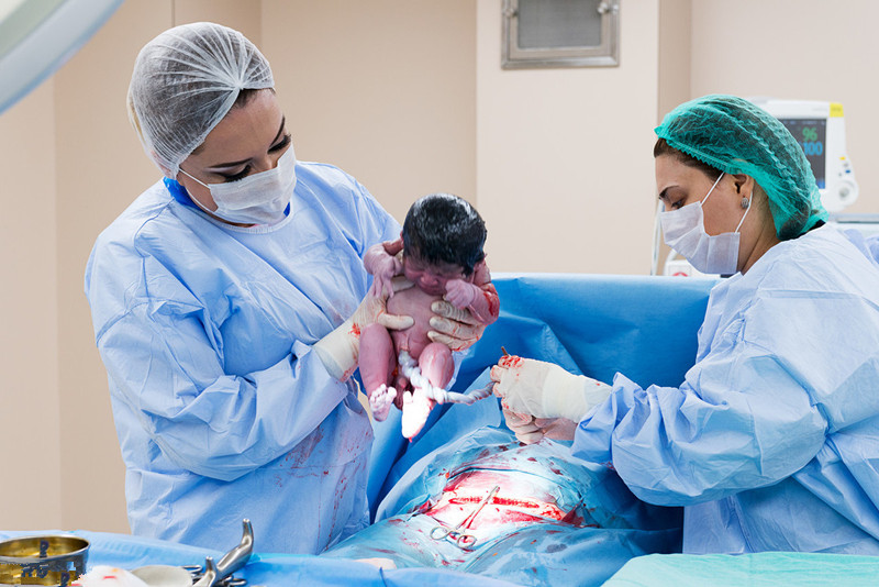 剖腹产-也许会影响孩子一生的健康！