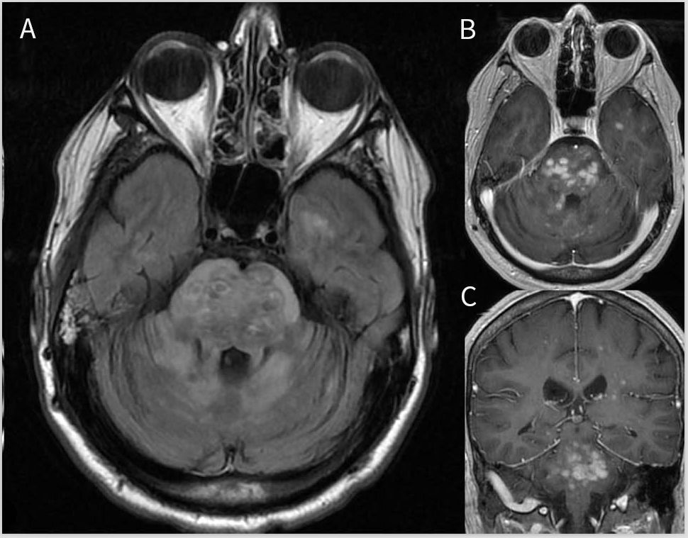 一文读懂13种最常见癌症筛查攻略,一文读懂5大慢性炎症检测项目