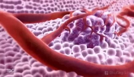 治疗甲状腺癌的十大西药,甲状腺癌有什么药物可治疗