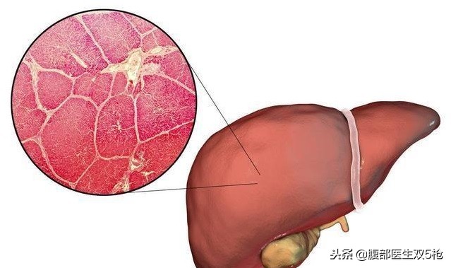 肝癌晚期肝移植成功后可以活几年,肝癌破裂出血介入后有活10年的吗