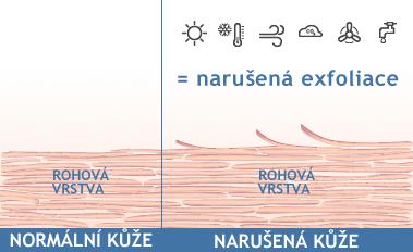 冬天皮肤变得粗糙怎么办,冬天皮肤为什么容易起皮