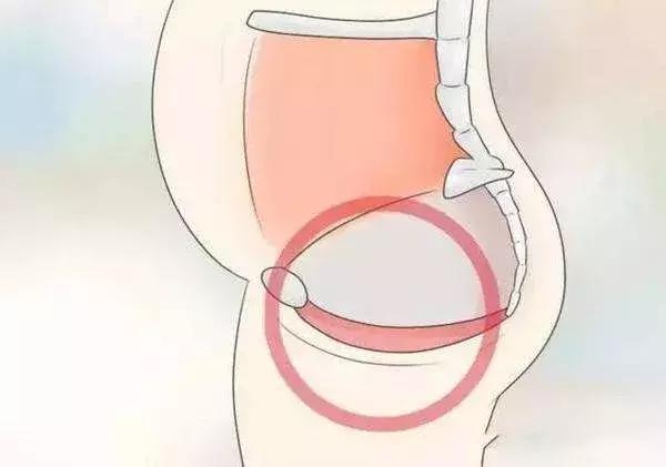 明星也经历过产后漏尿的窘迫，盆底肌锻炼教程看这一篇就够。