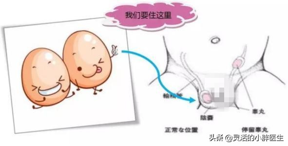 宝宝只有一个睾丸是什么原因,蛋蛋发育有什么不正常现象