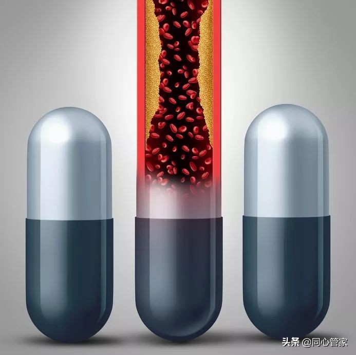 血管狭窄如何扼住生命的咽喉？让你全身器官都遭殃