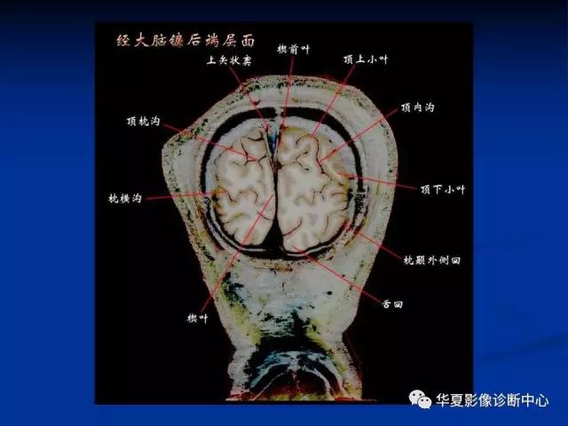 mra头颅解剖学详细讲解视频,常见的头颅mri图像