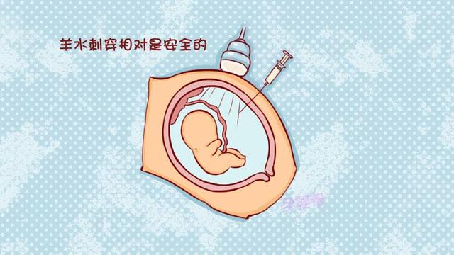 羊水穿刺真的那么可怕？先别急着紧张，看你符合标准吗？