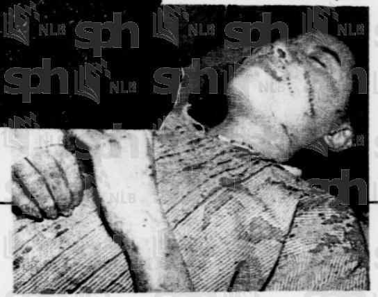 被前两任丈夫毁容家暴,惨遭丈夫家暴32年痛不欲生