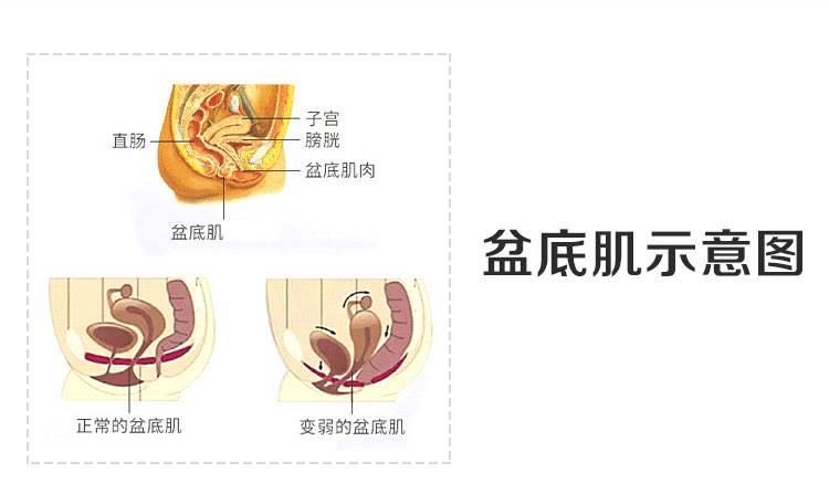 孕期尴尬：孕期打喷嚏漏尿怎么办？盆底肌了解下