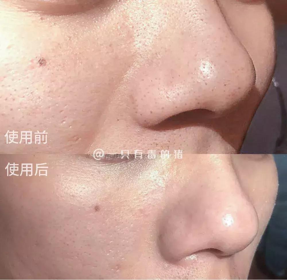 网红面膜清洁面膜,网红同款清洁面膜美白