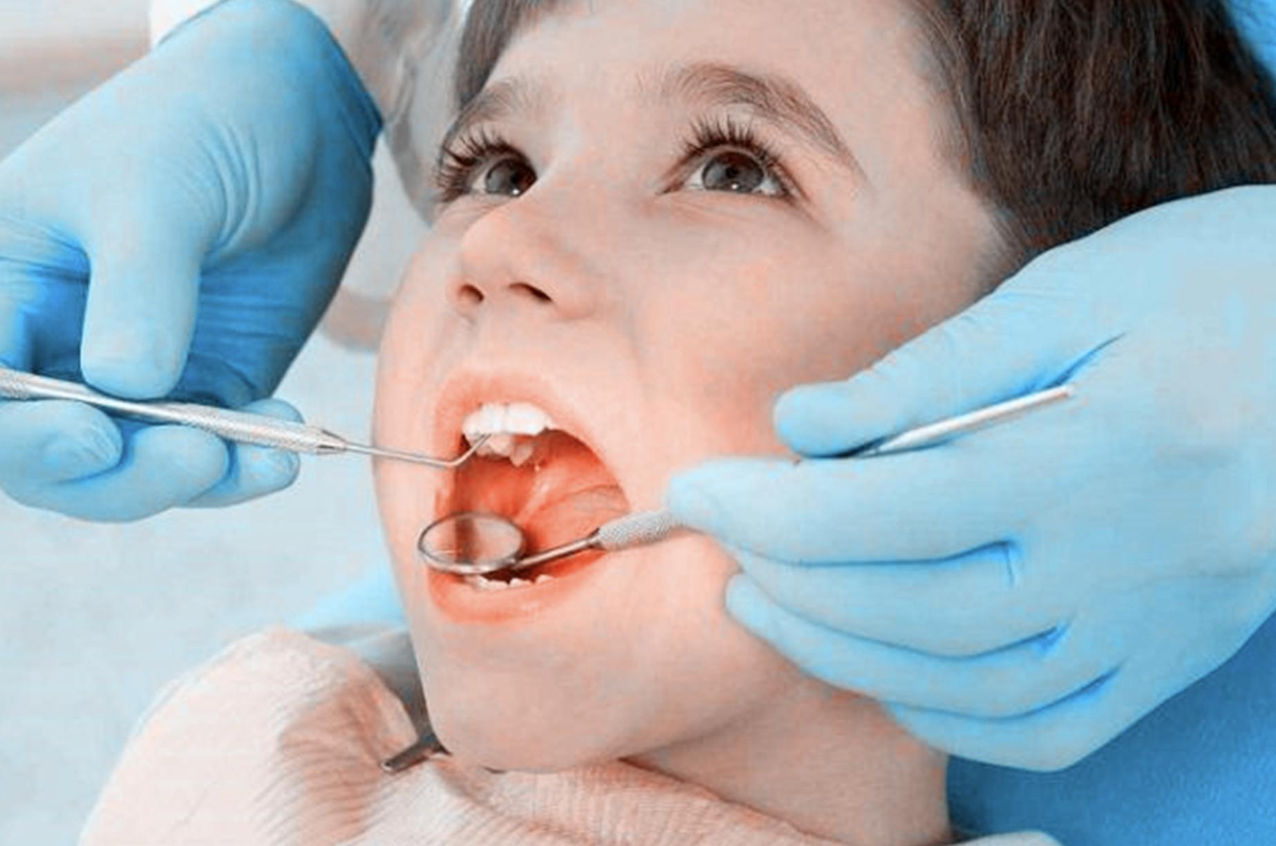 乳牙换牙年龄顺序图动画,上下各12颗乳牙换牙顺序图