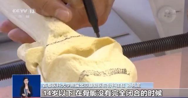 直腿神器,直腿矫正神器