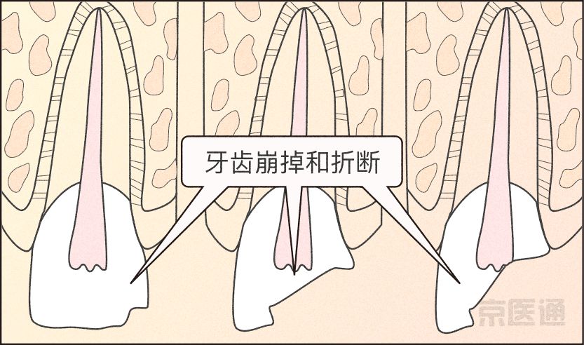 磨牙不好是真的吗,磨牙的危害与关注事项