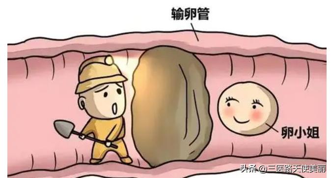 女性不孕不育的原因有哪些,女性不孕不育主要有哪些原因