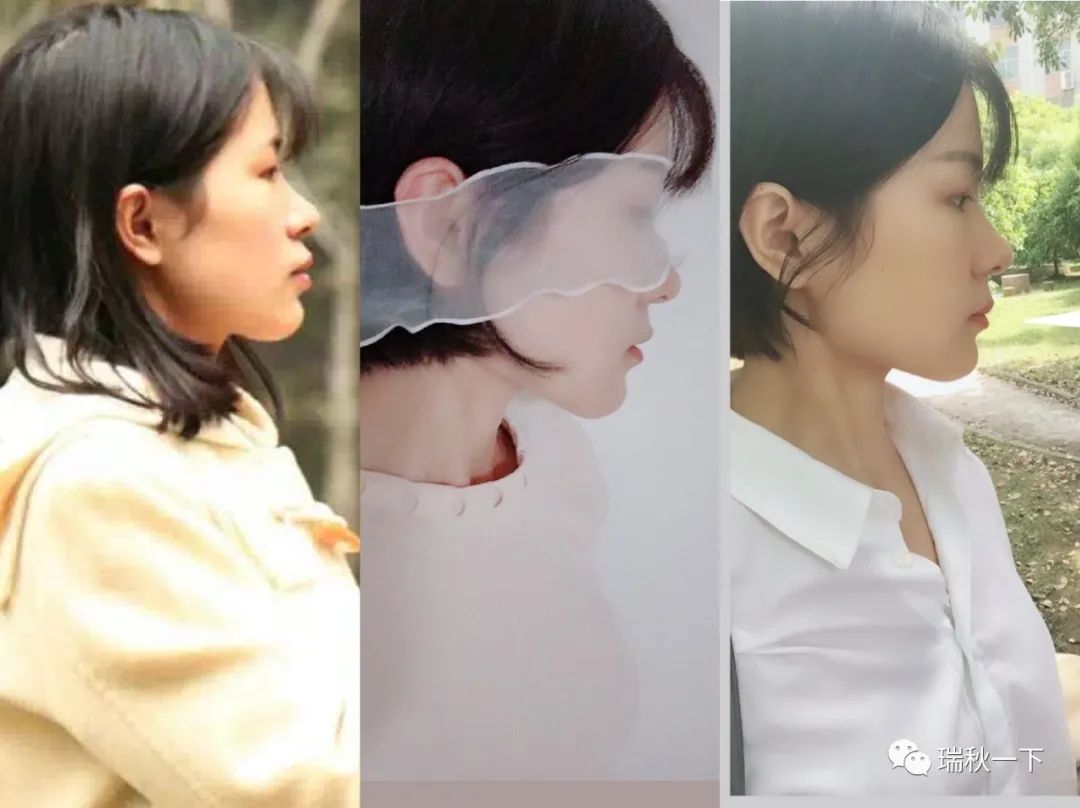 牙齿矫正，你后悔了吗？