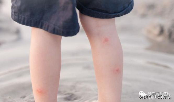 家里蚊子多怎么办只需简单一招,家里蚊子很多教你一招蚊子死光光