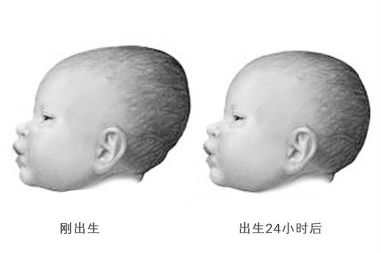 囟门闭合太早是不是就会说话了,宝宝囟门闭合早晚对智力有影响吗
