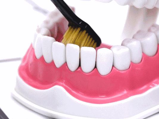 烤瓷牙基底冠如何清洁不崩瓷,烤瓷牙咬合面崩瓷必须重做吗