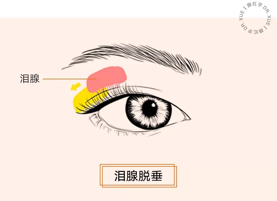 三层眼皮女人的特点,哪种眼皮最好看