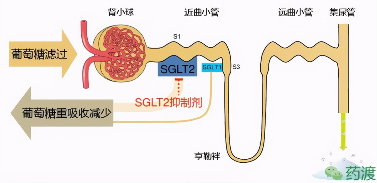 2型糖尿病血汗管危险分级,2类糖尿病如何预防