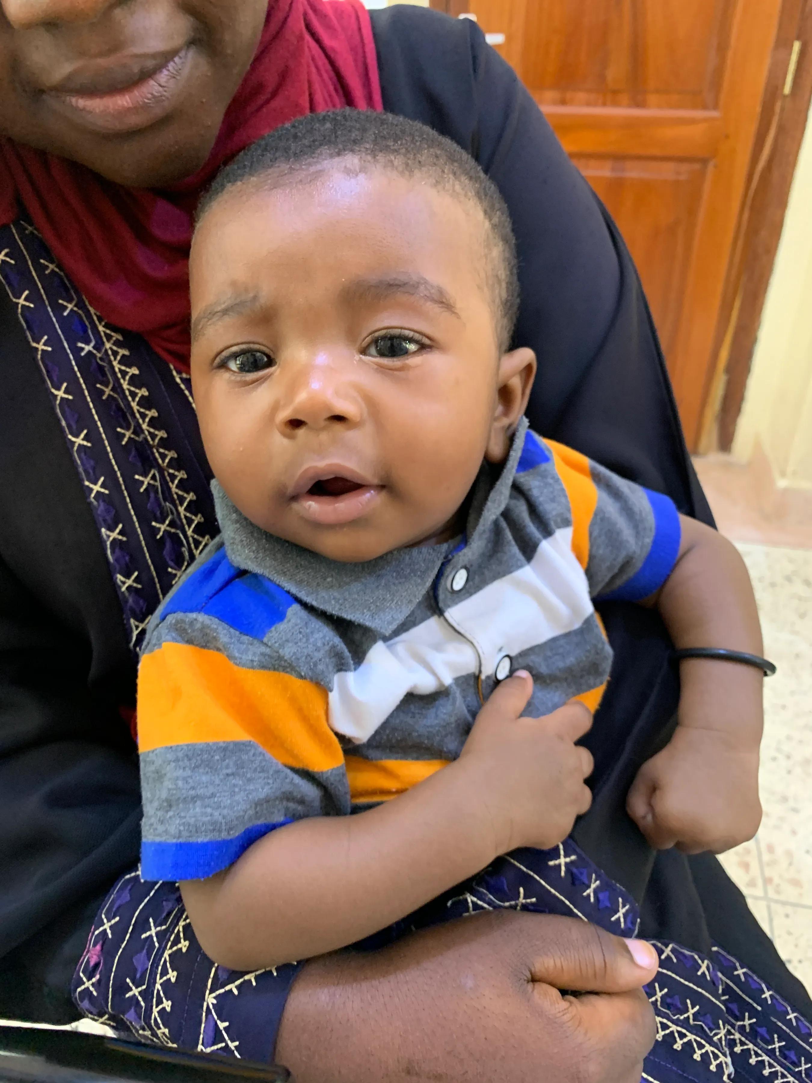 在非洲桑给巴尔为青光眼患者做手术