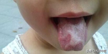 宝宝舌头能反映什么病,看孩子的舌头知道身体状况