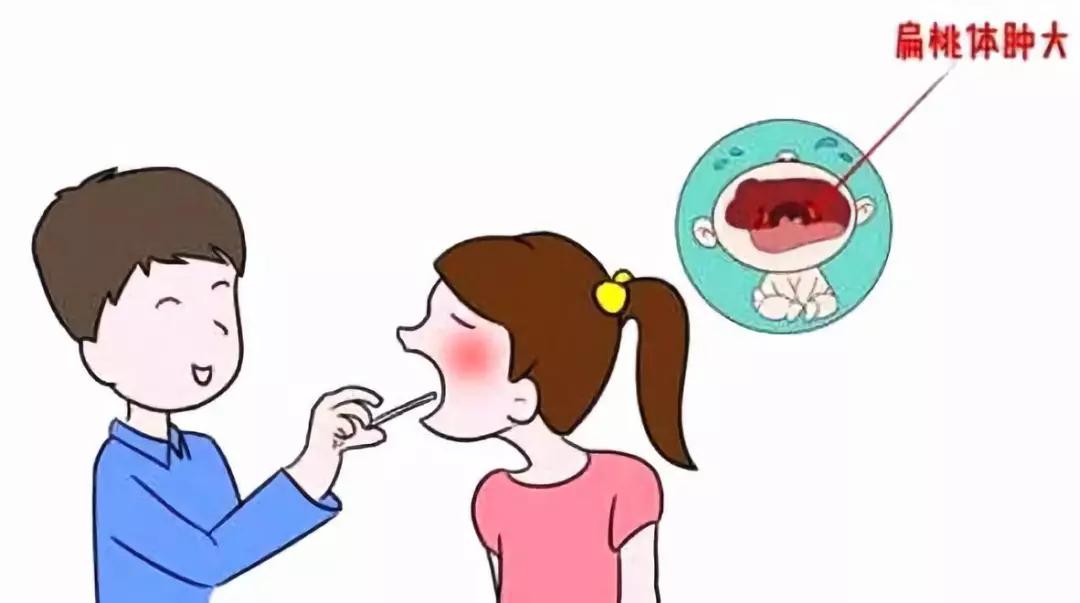 小孩扁桃体反复发炎怎么办,成年人扁桃体反复发炎怎么办