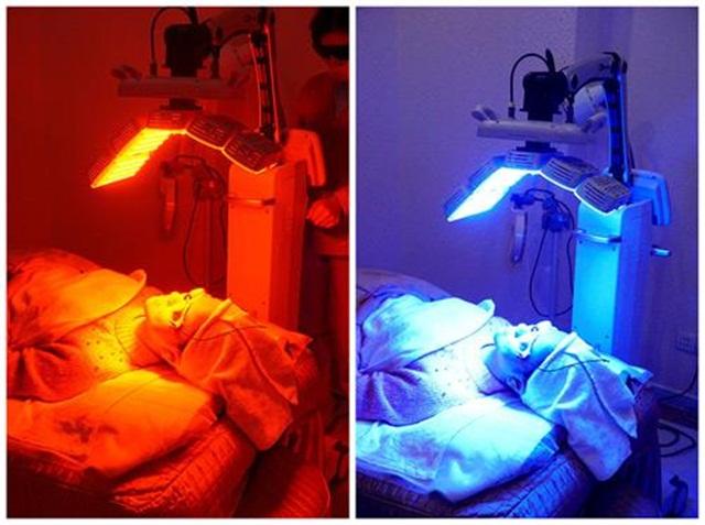 痘印严重到底怎么办,毁容式痘痘有什么办法消除