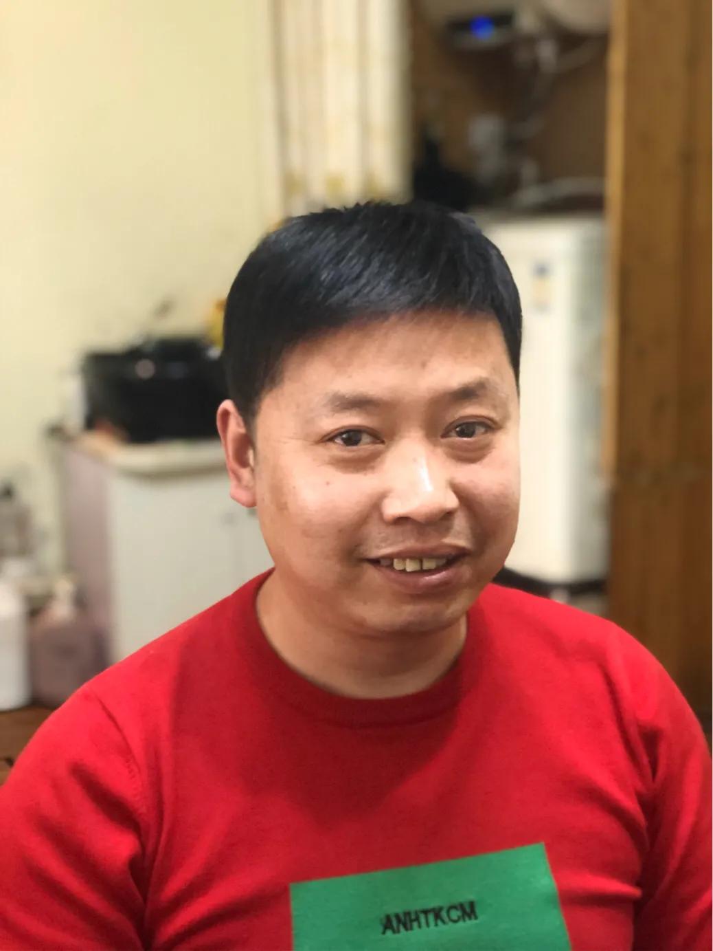 脱发到底该怎么应对,女脱发严重怎么解决